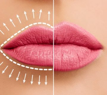 Plumper Lips & Smooth Skin