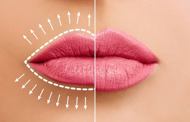 Plumper Lips & Smooth Skin